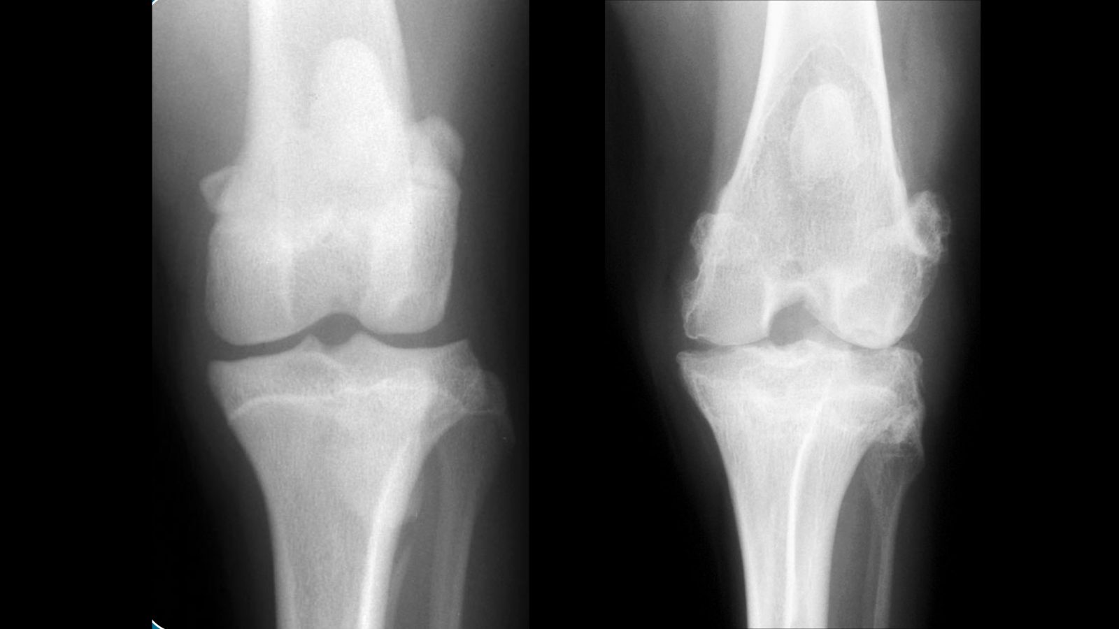 Cruciate Disease - KYON