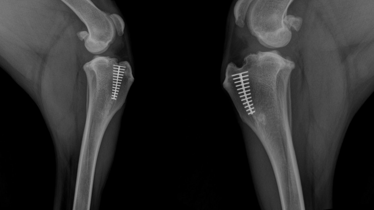 tta-2-tibial-tuberosity-advancement-kyon